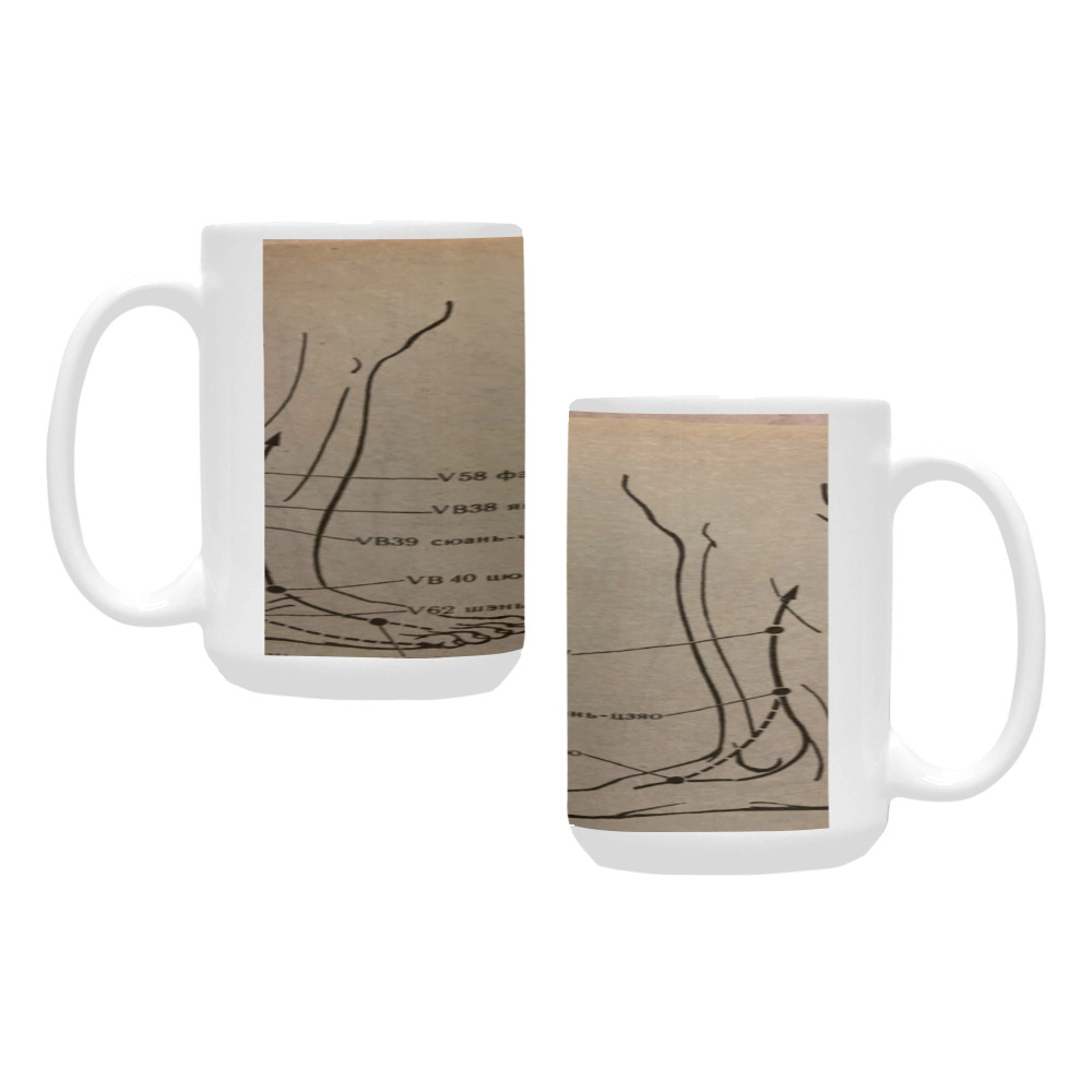 aches in low extremities and syndromes. Custom Ceramic Mug (15OZ)