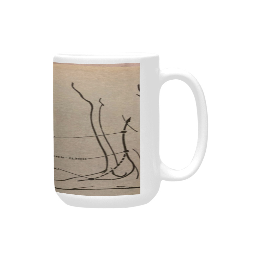 aches in low extremities and syndromes. Custom Ceramic Mug (15OZ)