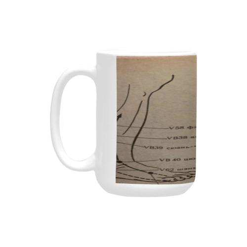 aches in low extremities and syndromes. Custom Ceramic Mug (15OZ)